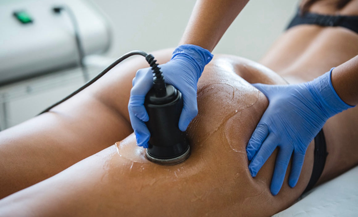 Liposuzione ad Ultrasuoni Corpo