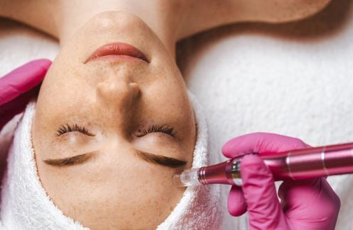 Needling Viso Trattamento estetico avanzato