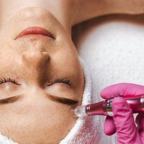 Needling Viso Trattamento estetico avanzato