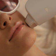 Epilazione laser a diodo